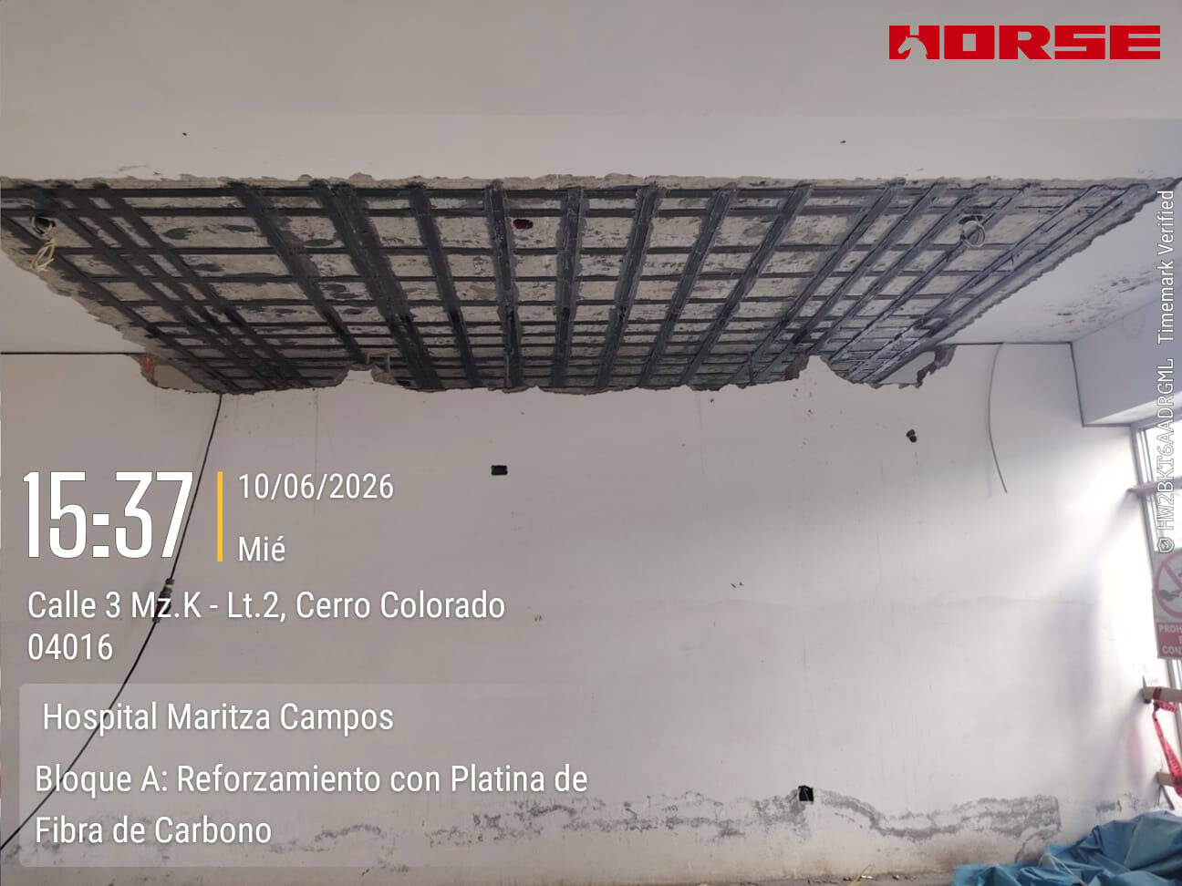 Seismic Strengthening of Hospital Slab Using CFRP Plate