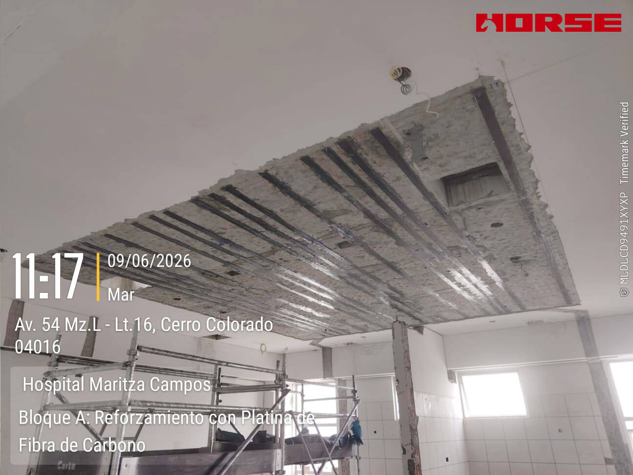 Seismic Strengthening of Hospital Slab Using CFRP Plate